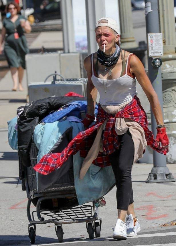 Ünlü model Loni Willison ön dişleri dökük yine çöp toplarken görüntülendi - Resim: 24